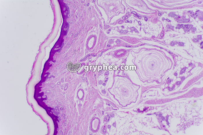 Peau du doigt avec corpuscules de Pacini x10 - gryphea.org